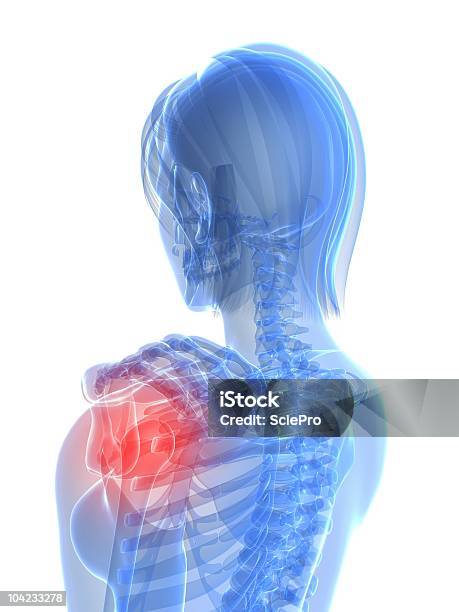 肩の痛み - 女性像のストックフォトや画像を多数ご用意 - 女性像, 3D, X線撮影