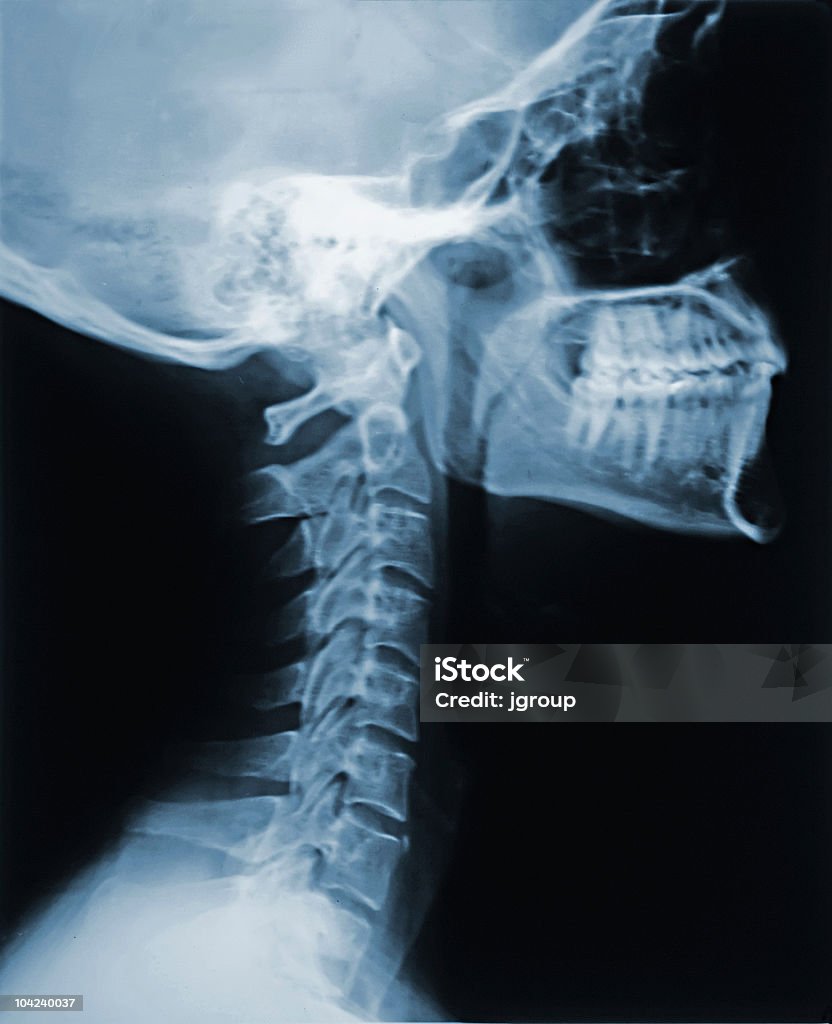 X-Ray de la nuque - Photo de Anatomie libre de droits