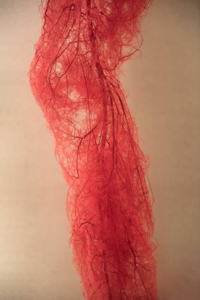 istock Blood Vessels of human leg 1042446962