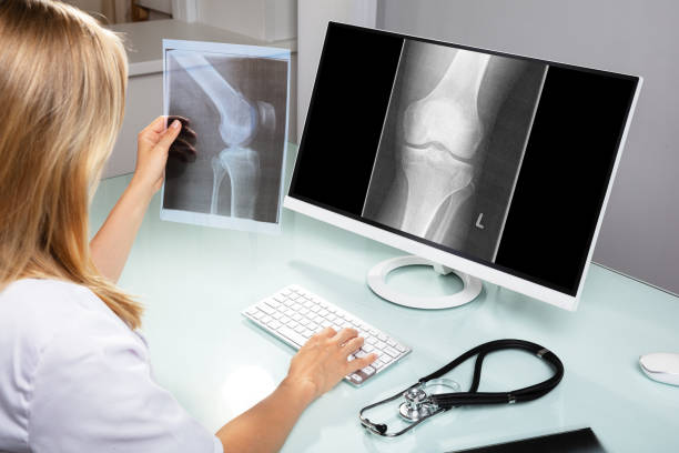 istock Doctor Examining Knee X-ray 1042650956