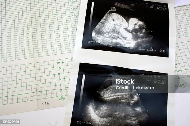 Cardiograph E Ultrasuoni - Fotografie stock e altre immagini di Ecografia - Ecografia, Elettrocardiogramma, Feto - Stadio della procreazione umana