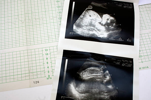 istock cardiograph and ultrasound 104320401