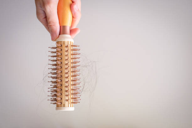 istock hair fall and lost alopecia woman problem on the comb. 1043293002