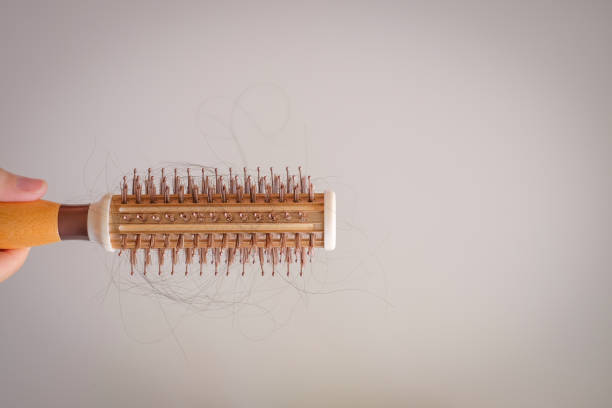 istock hair fall and lost alopecia woman problem on the comb. 1043293004