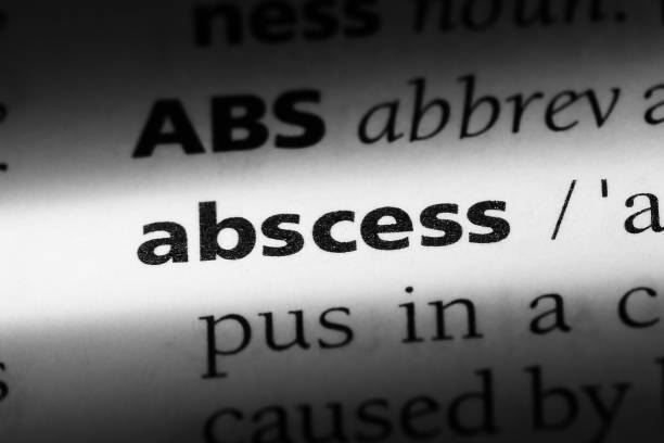 istock abscess word in a dictionary. abscess concept. 1043834638