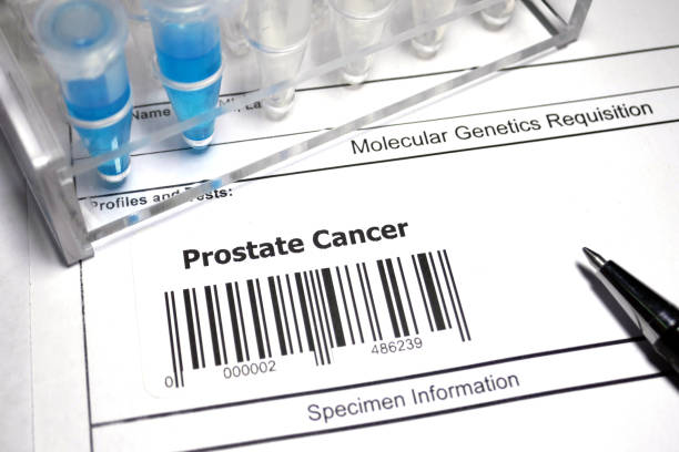 Prostate cancer Genetic research abstract - Prostate cancer technology office equipment laboratory stock pictures, royalty-free photos & images