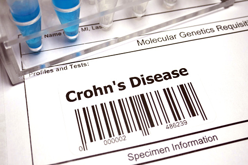 Genetic research abstract - Crohn's disease