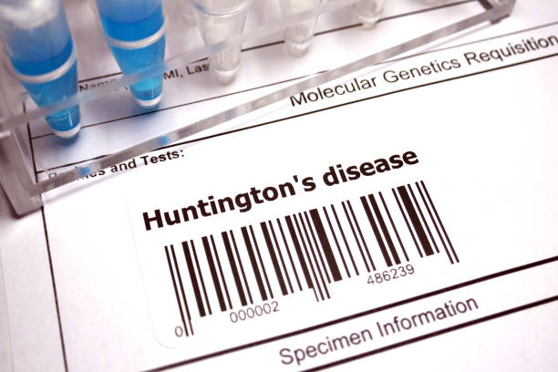 huntington의 질병 - chromosome biotechnology laboratory tube 뉴스 사진 이미지