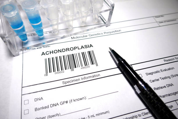 achondroplasia - chromosome biotechnology laboratory tube 뉴스 사진 이미지