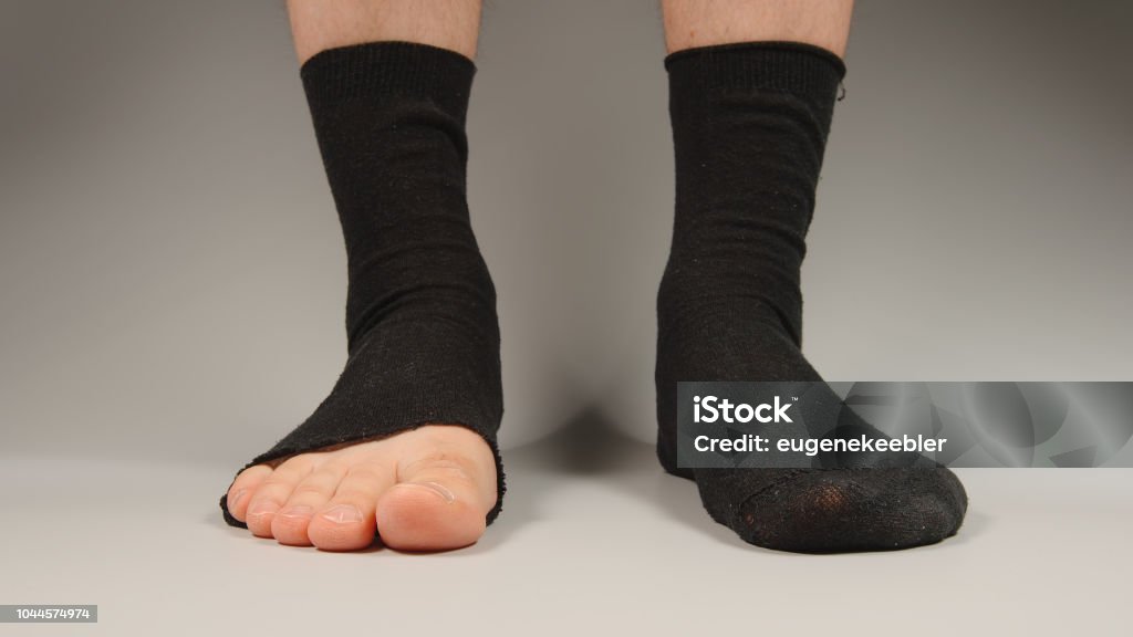 Sock With A Hole On The Mans Legs Front View Stock Photo - Download Image  Now - Hole, Sock, Adult - iStock