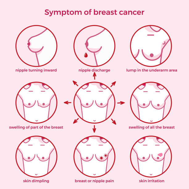 objawy raka piersi. - symptom stock illustrations