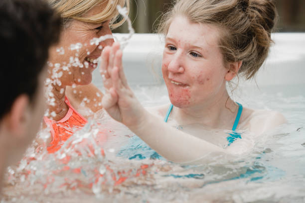 jouant dans la piscine d’hydrothérapie - disabled teenager adolescence physical impairment photos et images de collection