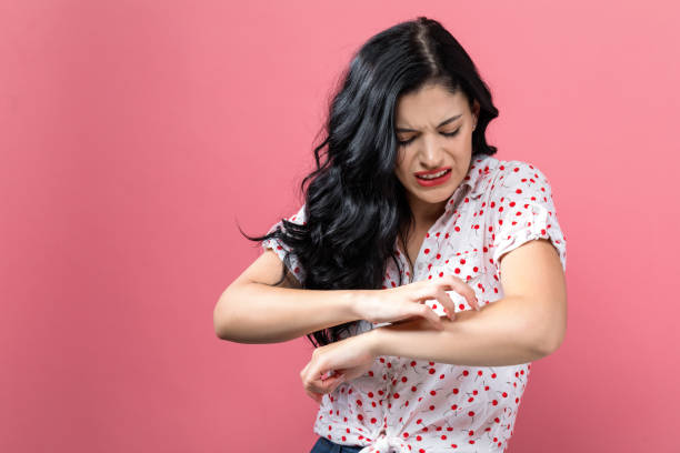 Young woman scratching her itchy arm. stock photo