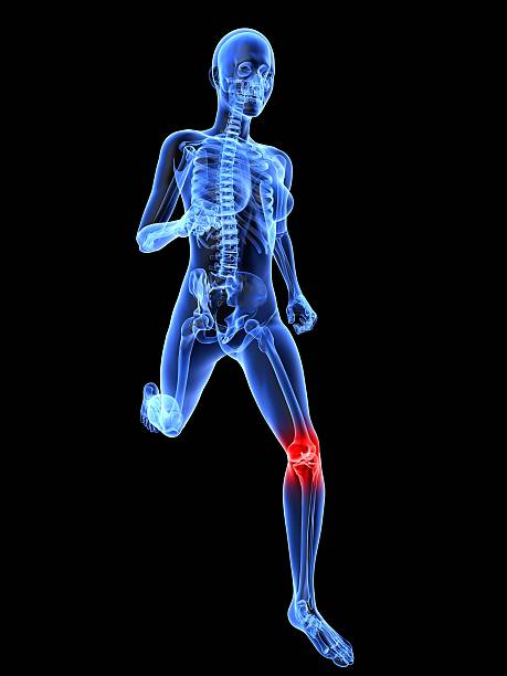 bolesne kolana ilustracja - x ray human knee orthopedic equipment human bone zdjęcia i obrazy z banku zdjęć