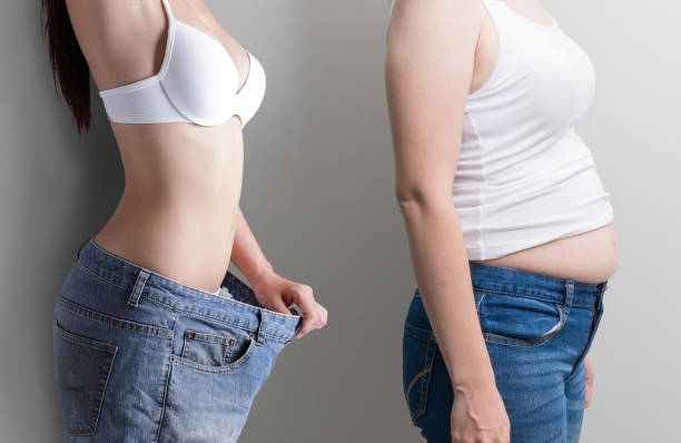 frau mit bauch-verlust-konzept - overweight tummy tuck abdomen body stock-fotos und bilder