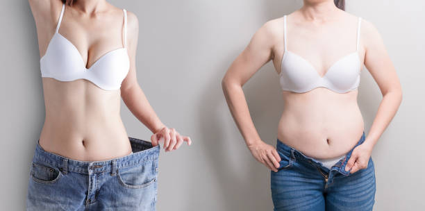 woman with abdomen loss concept - overweight tummy tuck abdomen body imagens e fotografias de stock
