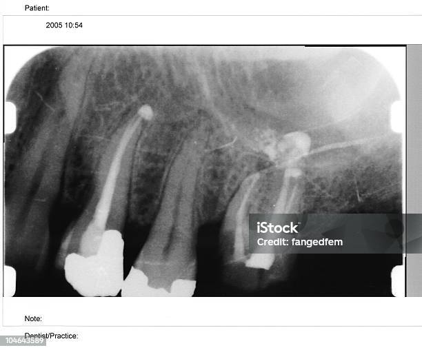 Zdjęcie Rentgenowskie - zdjęcia stockowe i więcej obrazów Dane - Dane, Dentysta, Diagnostyka obrazowa