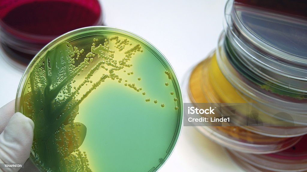 Microbiology, bacterial culture plates  Lifestyles Stock Photo