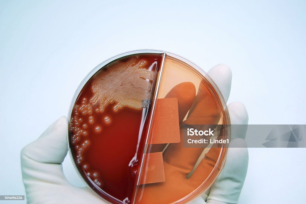 Culture of Streptococcus  Analyzing Stock Photo