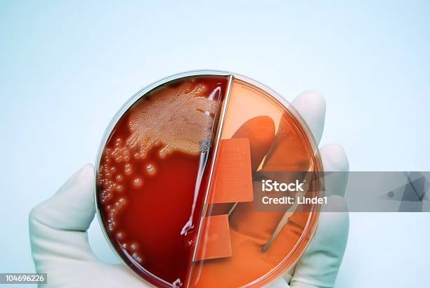 Culture Of Streptococcus Stock Photo - Download Image Now - Analyzing, Antibiotic, Bacterium