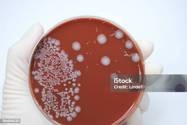 E Coli - Fotografias de stock e mais imagens de Disco de Petri - Disco de Petri, E. coli, Analisar