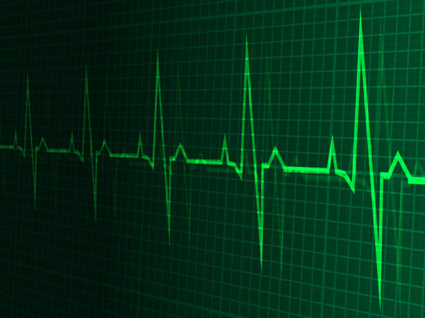 istock heart rate, heartbeat, neon line, green graphic background. In perspective. Realistic style. Vector illustration. 1047013550