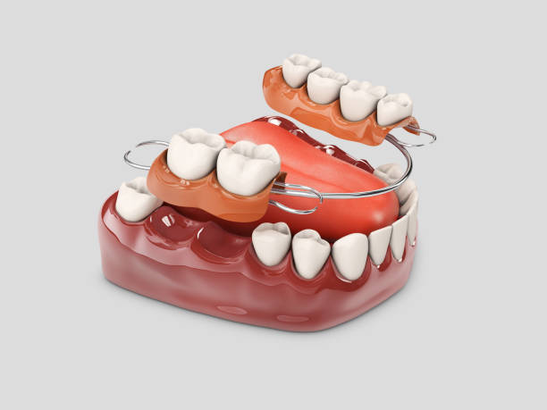 istock Human teeth with denture. 3d illustration isolated white 1047184378
