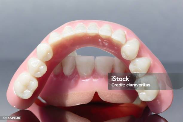 Photo libre de droit de Dents De La Mâchoire Prothèse Médicale Isolés Sur Fond Gris banque d'images et plus d'images libres de droit de Dentier