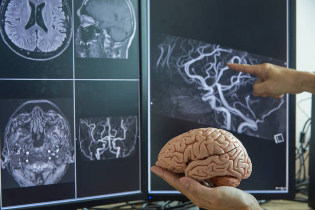 istock Brain model on doctor hand and MRI image 1047453114