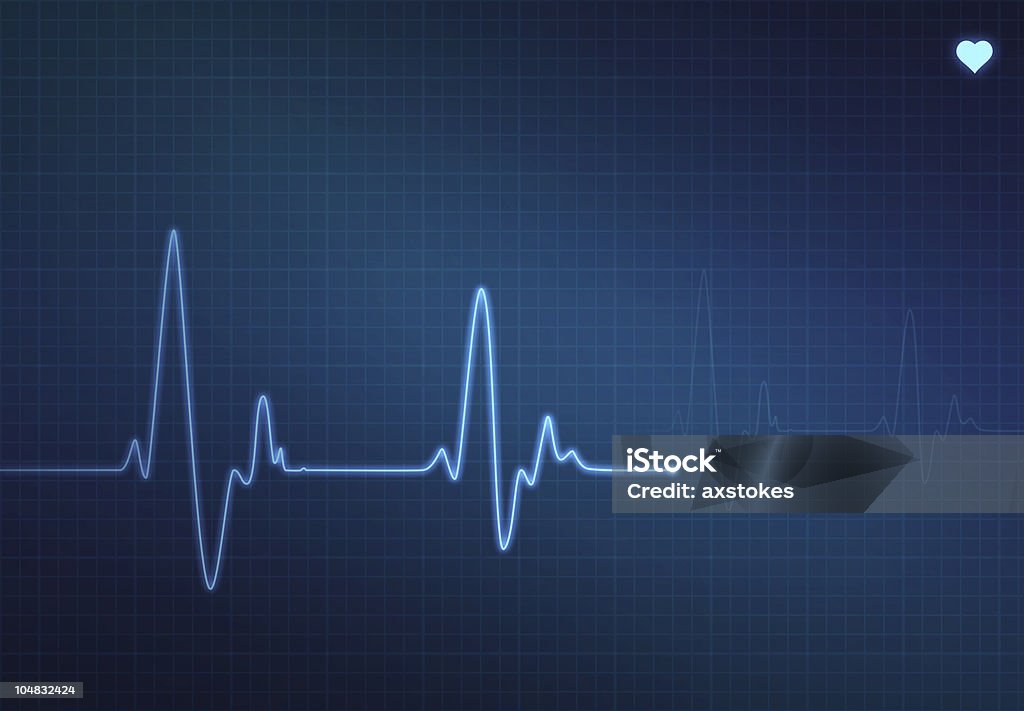 Monitor del battito cardiaco - Illustrazione stock royalty-free di Elettrocardiogramma