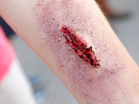 Realistic Wound cut arm cinmatic trick closeup