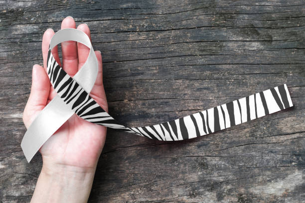 Carcinoid Cancer Awareness ribbon zebra stripe pattern on helping hand support and old aged wood Carcinoid Cancer Awareness ribbon zebra stripe pattern on helping hand support and old aged wood beast cancer awareness month stock pictures, royalty-free photos & images