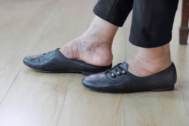 istock Elderly woman putting on shoes. 1048695864