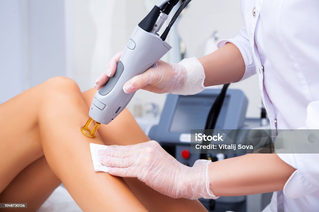 épilation au laser procédure pour jambe - Photo de Épilation libre de droits