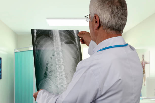 medico maturo che esamina un'immagine a raggi x - rib cage people x ray image x ray foto e immagini stock