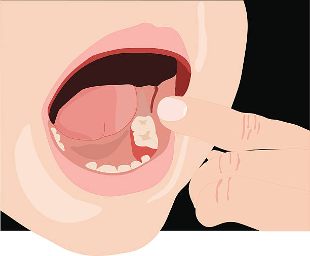 Missing Tooth (Vector) vector art illustration