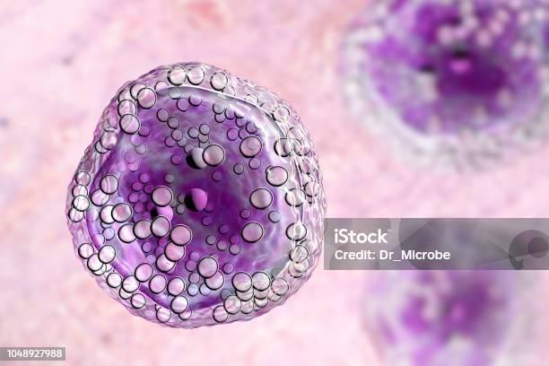 Células De Linfoma De Burkitt Es Un Cáncer Del Sistema Linfático Foto de stock y más banco de imágenes de Célula cancerígena de animal