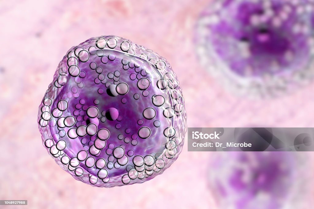 Burkitt's lymphoma cell, is a cancer of the lymphatic system Burkitt's lymphoma cells, is a cancer of the lymphatic system, a monoclonal B-cell tumor, 3D illustration Cancer Cell Stock Photo