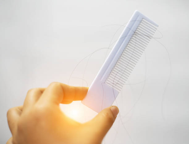 istock In selective focus of hair fall and white come,blurry light design background 1049598716