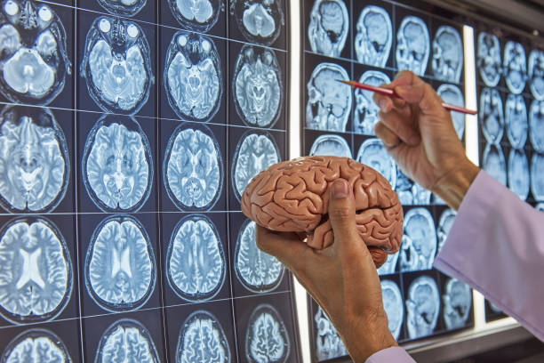 neurochirurg trzymający model mózgu i wskazujący na mri mózgu - radiogram photographic image zdjęcia i obrazy z banku zdjęć