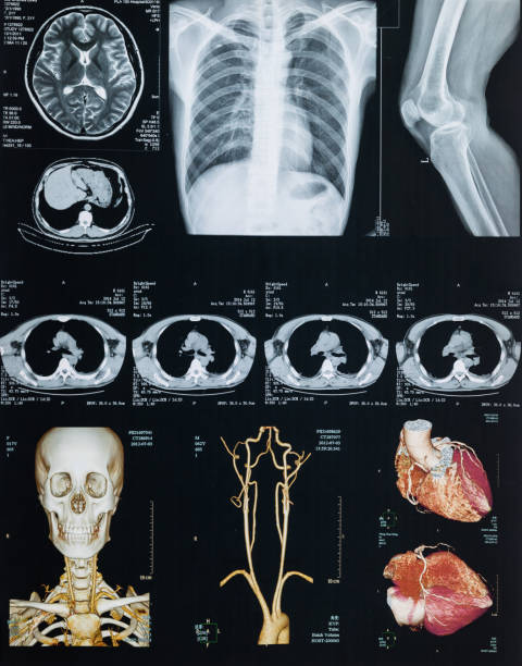 ct/raggi x/nmr esame completo del corpo - mri scan cat scan machine x ray brain foto e immagini stock