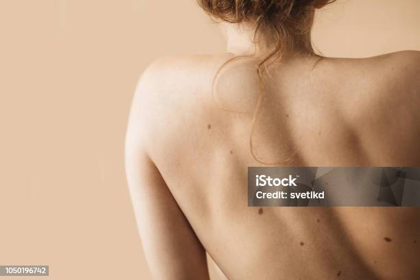 Woman Body Stock Photo - Download Image Now - The Human Body, Mole - Skin, Women