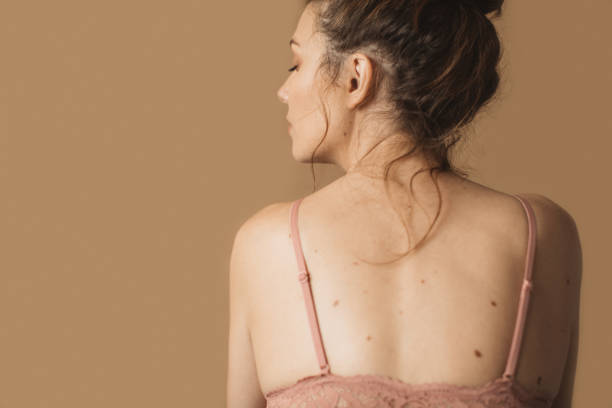 istock Woman body 1050196762