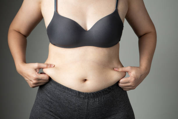 istock fat woman cellulite belly unhealthy 1050251276