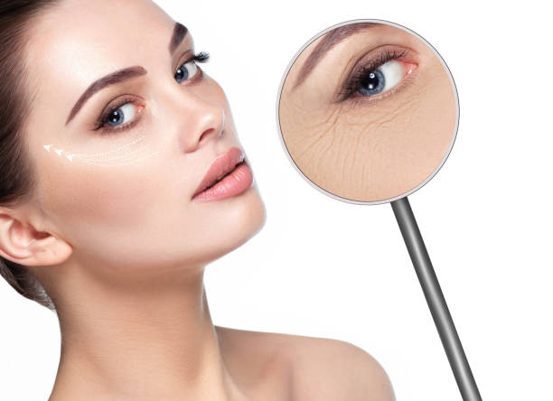 magnifying glass showing Wrinkles around the eyes