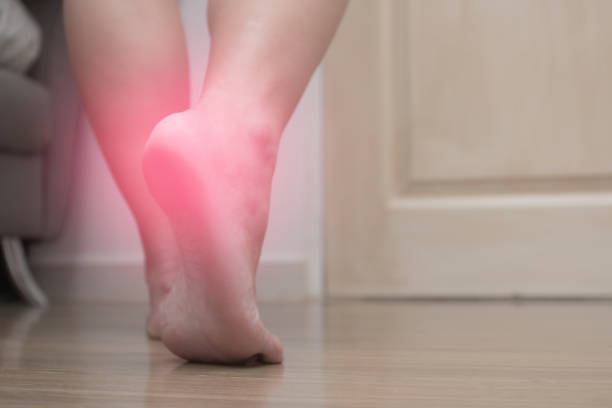 closeup de dolor de talón de pie derecho femenino, con fascitis plantar, punto rojo - sport massaging accident adult fotografías e imágenes de stock