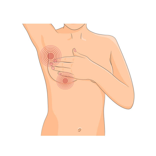 samozdjęcie piersi chory - self massage stock illustrations