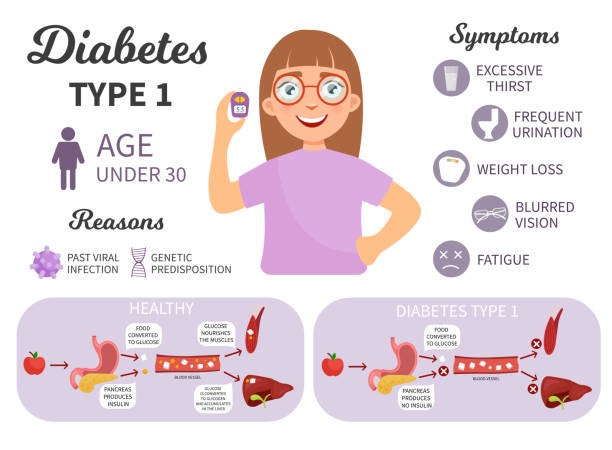 Diabetes type 2 infographics. vector art illustration