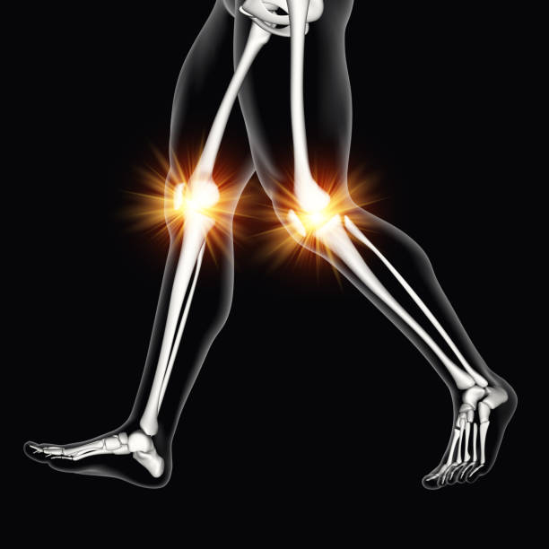 istock 3D male medical figure with knee bones highlighted 1051176528