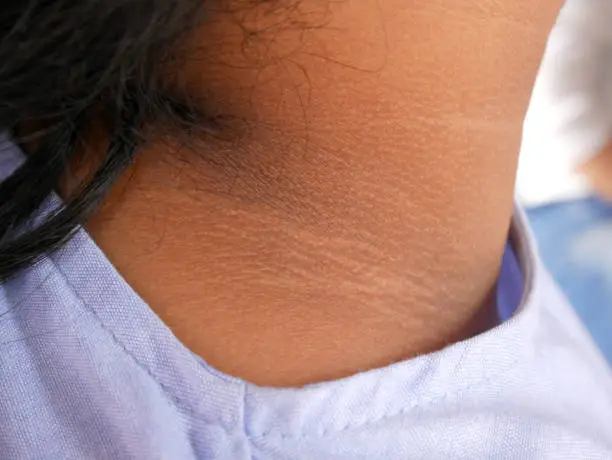 Photo of Black neck skin texture close up.